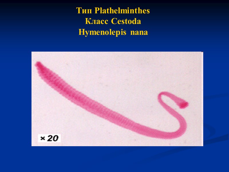 Тип Plathelminthes Класс Cestoda Hymenolepis nana